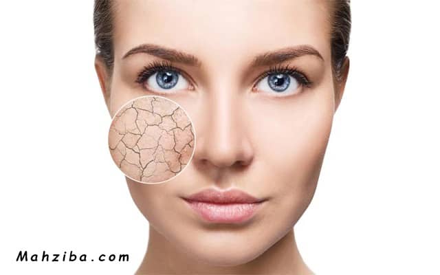 رتینول برای پوست خشک و حساس